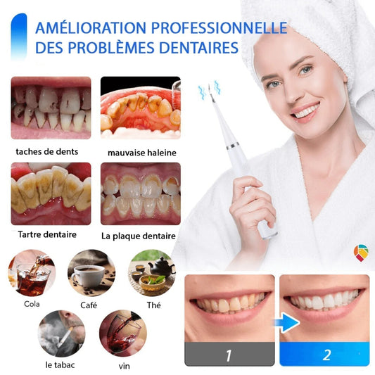 Appareil de nettoyage des dents